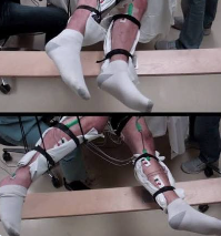 Person receiving treatment for restricted joint mobility
