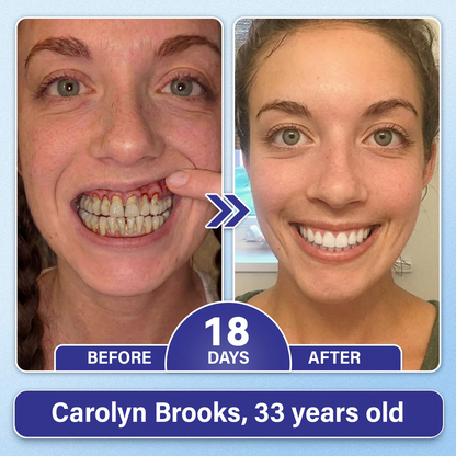 Chlovelxy Tooth & Gum Repair Fast-Dissolving Microneedle Patch✨ (𝟓-𝐢𝐧-𝟏 💎 𝐑𝐞𝐛𝐮𝐢𝐥𝐝 𝐄𝐧𝐚𝐦𝐞𝐥 & 𝐃𝐞𝐧𝐭𝐢𝐧 • 𝐒𝐭𝐫𝐞𝐧𝐠𝐭𝐡𝐞𝐧 𝐆𝐮𝐦𝐬 • 𝐄𝐫𝐚𝐝𝐢𝐜𝐚𝐭𝐞 𝐓𝐚𝐫𝐭𝐚𝐫 & 𝐎𝐝𝐨𝐫 • 𝐖𝐡𝐢𝐭𝐞𝐧𝐢𝐧𝐠 • 𝐒𝐭𝐨𝐩 𝐓𝐨𝐨𝐭𝐡 𝐒𝐞𝐧𝐬𝐢𝐭𝐢𝐯𝐢𝐭𝐲)