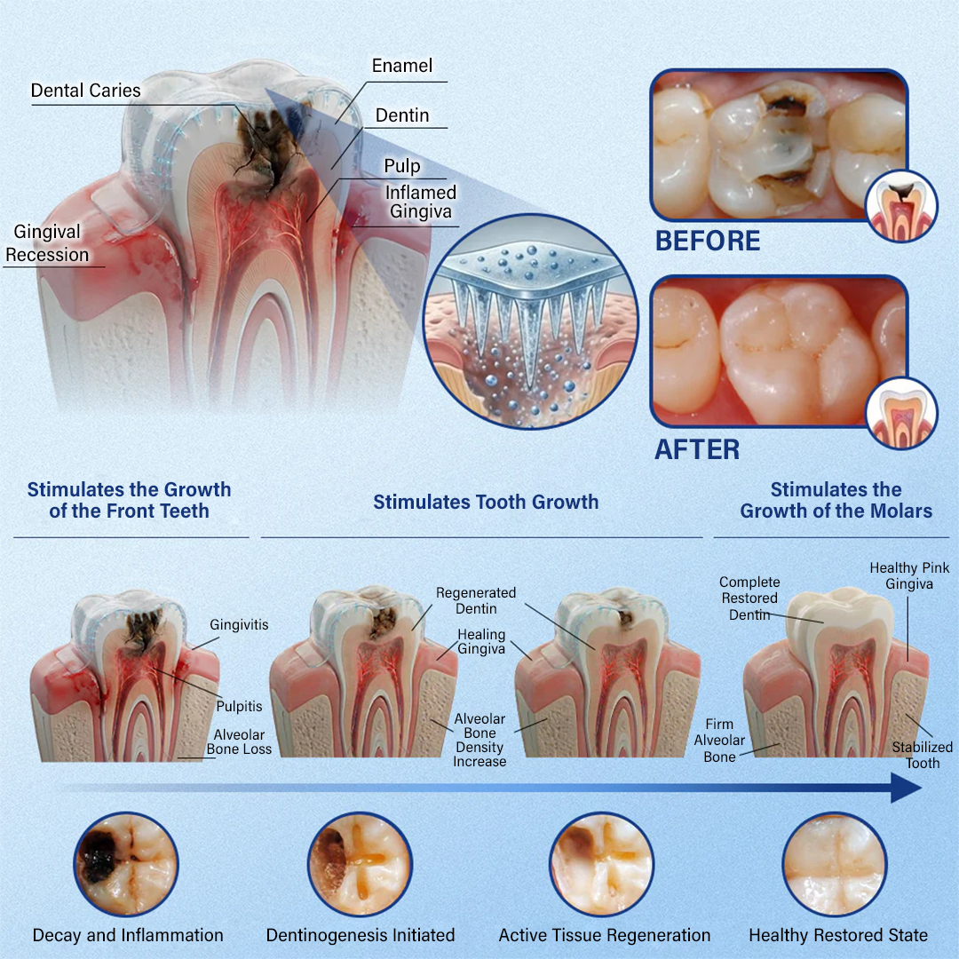 Lumina Tooth & Gum Repair Fast-Dissolving Microneedle Patch✨ (𝟓-𝐢𝐧-𝟏 💎 𝐑𝐞𝐛𝐮𝐢𝐥𝐝 𝐄𝐧𝐚𝐦𝐞𝐥 & 𝐃𝐞𝐧𝐭𝐢𝐧 • 𝐒𝐭𝐫𝐞𝐧𝐠𝐭𝐡𝐞𝐧 𝐆𝐮𝐦𝐬 • 𝐄𝐫𝐚𝐝𝐢𝐜𝐚𝐭𝐞 𝐓𝐚𝐫𝐭𝐚𝐫 & 𝐎𝐝𝐨𝐫 • 𝐖𝐡𝐢𝐭𝐞𝐧𝐢𝐧𝐠 • 𝐒𝐭𝐨𝐩 𝐓𝐨𝐨𝐭𝐡 𝐒𝐞𝐧𝐬𝐢𝐭𝐢𝐯𝐢𝐭𝐲)