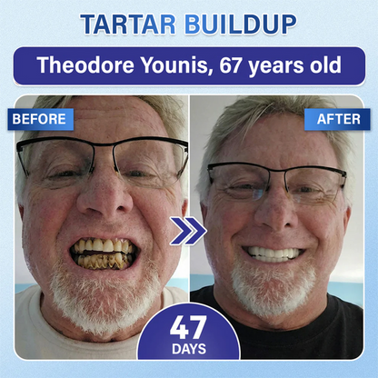Lumina Tooth & Gum Repair Fast-Dissolving Microneedle Patch✨ (𝟓-𝐢𝐧-𝟏 💎 𝐑𝐞𝐛𝐮𝐢𝐥𝐝 𝐄𝐧𝐚𝐦𝐞𝐥 & 𝐃𝐞𝐧𝐭𝐢𝐧 • 𝐒𝐭𝐫𝐞𝐧𝐠𝐭𝐡𝐞𝐧 𝐆𝐮𝐦𝐬 • 𝐄𝐫𝐚𝐝𝐢𝐜𝐚𝐭𝐞 𝐓𝐚𝐫𝐭𝐚𝐫 & 𝐎𝐝𝐨𝐫 • 𝐖𝐡𝐢𝐭𝐞𝐧𝐢𝐧𝐠 • 𝐒𝐭𝐨𝐩 𝐓𝐨𝐨𝐭𝐡 𝐒𝐞𝐧𝐬𝐢𝐭𝐢𝐯𝐢𝐭𝐲)