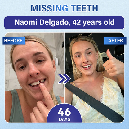 Lumina Tooth & Gum Repair Fast-Dissolving Microneedle Patch✨ (𝟓-𝐢𝐧-𝟏 💎 𝐑𝐞𝐛𝐮𝐢𝐥𝐝 𝐄𝐧𝐚𝐦𝐞𝐥 & 𝐃𝐞𝐧𝐭𝐢𝐧 • 𝐒𝐭𝐫𝐞𝐧𝐠𝐭𝐡𝐞𝐧 𝐆𝐮𝐦𝐬 • 𝐄𝐫𝐚𝐝𝐢𝐜𝐚𝐭𝐞 𝐓𝐚𝐫𝐭𝐚𝐫 & 𝐎𝐝𝐨𝐫 • 𝐖𝐡𝐢𝐭𝐞𝐧𝐢𝐧𝐠 • 𝐒𝐭𝐨𝐩 𝐓𝐨𝐨𝐭𝐡 𝐒𝐞𝐧𝐬𝐢𝐭𝐢𝐯𝐢𝐭𝐲)