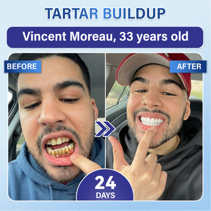 Lumina Tooth & Gum Repair Fast-Dissolving Microneedle Patch✨ (𝟓-𝐢𝐧-𝟏 💎 𝐑𝐞𝐛𝐮𝐢𝐥𝐝 𝐄𝐧𝐚𝐦𝐞𝐥 & 𝐃𝐞𝐧𝐭𝐢𝐧 • 𝐒𝐭𝐫𝐞𝐧𝐠𝐭𝐡𝐞𝐧 𝐆𝐮𝐦𝐬 • 𝐄𝐫𝐚𝐝𝐢𝐜𝐚𝐭𝐞 𝐓𝐚𝐫𝐭𝐚𝐫 & 𝐎𝐝𝐨𝐫 • 𝐖𝐡𝐢𝐭𝐞𝐧𝐢𝐧𝐠 • 𝐒𝐭𝐨𝐩 𝐓𝐨𝐨𝐭𝐡 𝐒𝐞𝐧𝐬𝐢𝐭𝐢𝐯𝐢𝐭𝐲)
