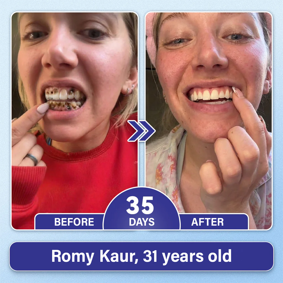 Chlovelxy Tooth & Gum Repair Fast-Dissolving Microneedle Patch✨ (𝟓-𝐢𝐧-𝟏 💎 𝐑𝐞𝐛𝐮𝐢𝐥𝐝 𝐄𝐧𝐚𝐦𝐞𝐥 & 𝐃𝐞𝐧𝐭𝐢𝐧 • 𝐒𝐭𝐫𝐞𝐧𝐠𝐭𝐡𝐞𝐧 𝐆𝐮𝐦𝐬 • 𝐄𝐫𝐚𝐝𝐢𝐜𝐚𝐭𝐞 𝐓𝐚𝐫𝐭𝐚𝐫 & 𝐎𝐝𝐨𝐫 • 𝐖𝐡𝐢𝐭𝐞𝐧𝐢𝐧𝐠 • 𝐒𝐭𝐨𝐩 𝐓𝐨𝐨𝐭𝐡 𝐒𝐞𝐧𝐬𝐢𝐭𝐢𝐯𝐢𝐭𝐲)