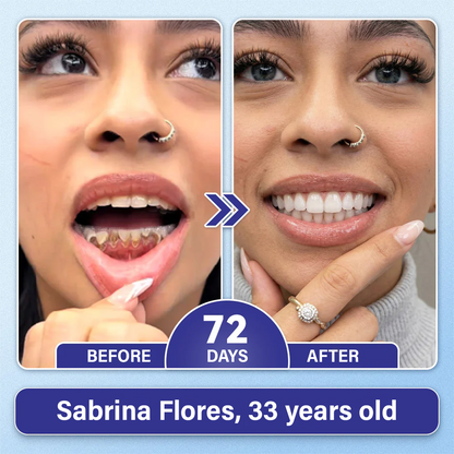Chlovelxy Tooth & Gum Repair Fast-Dissolving Microneedle Patch✨ (𝟓-𝐢𝐧-𝟏 💎 𝐑𝐞𝐛𝐮𝐢𝐥𝐝 𝐄𝐧𝐚𝐦𝐞𝐥 & 𝐃𝐞𝐧𝐭𝐢𝐧 • 𝐒𝐭𝐫𝐞𝐧𝐠𝐭𝐡𝐞𝐧 𝐆𝐮𝐦𝐬 • 𝐄𝐫𝐚𝐝𝐢𝐜𝐚𝐭𝐞 𝐓𝐚𝐫𝐭𝐚𝐫 & 𝐎𝐝𝐨𝐫 • 𝐖𝐡𝐢𝐭𝐞𝐧𝐢𝐧𝐠 • 𝐒𝐭𝐨𝐩 𝐓𝐨𝐨𝐭𝐡 𝐒𝐞𝐧𝐬𝐢𝐭𝐢𝐯𝐢𝐭𝐲)