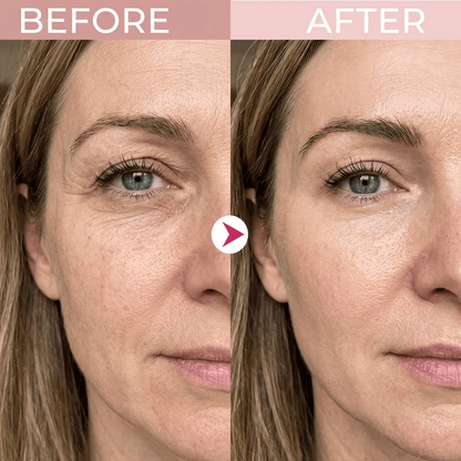 💖Trusted-by-over-50-000-women💖 Eye Renewal Crème - Chlovelxy
